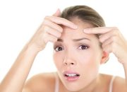 Jerawat Beruntusan? Simak 5 Tips Jitu Mengatasinya