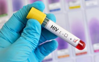 Ilustrasi HIV/AIDS. (Foto: iStock)