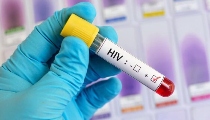 HIV/AIDS di Makassar Kian Mengkhawatirkan, Ada 454 Kasus Baru di 2025