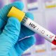 Ilustrasi HIV/AIDS. (Foto: iStock)